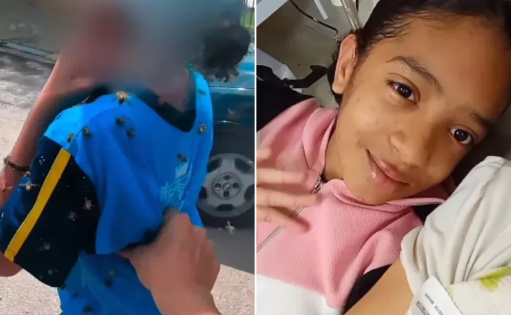 Menina que levou mais de 100 ferroadas de abelhas recebe alta em BH